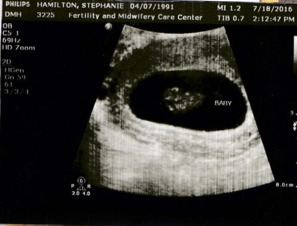 Baby 6 weeks
